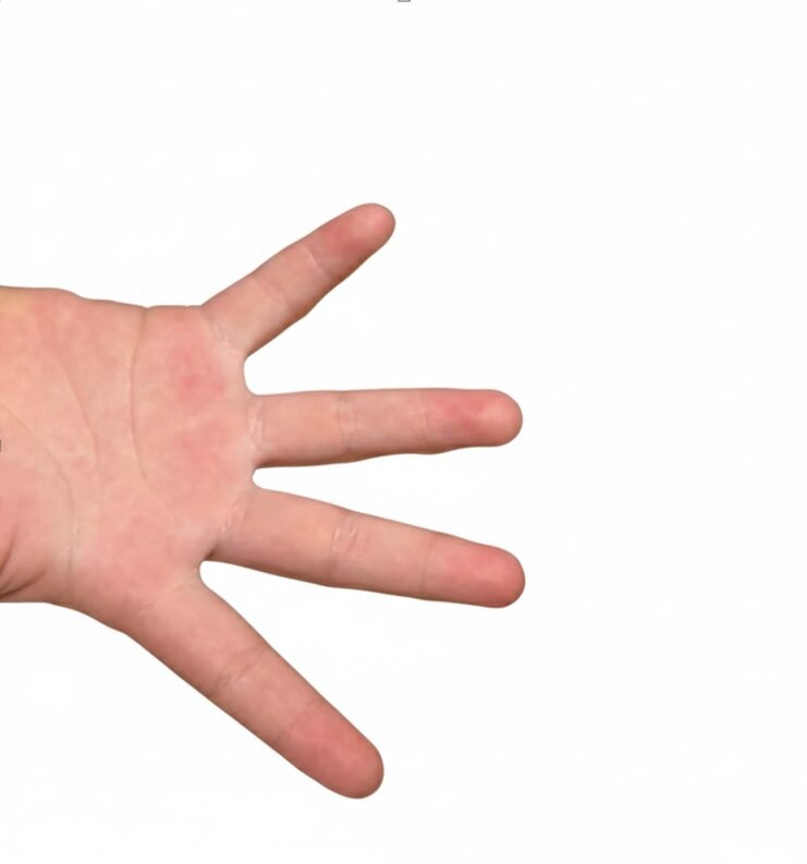 毛細血管再充満時間