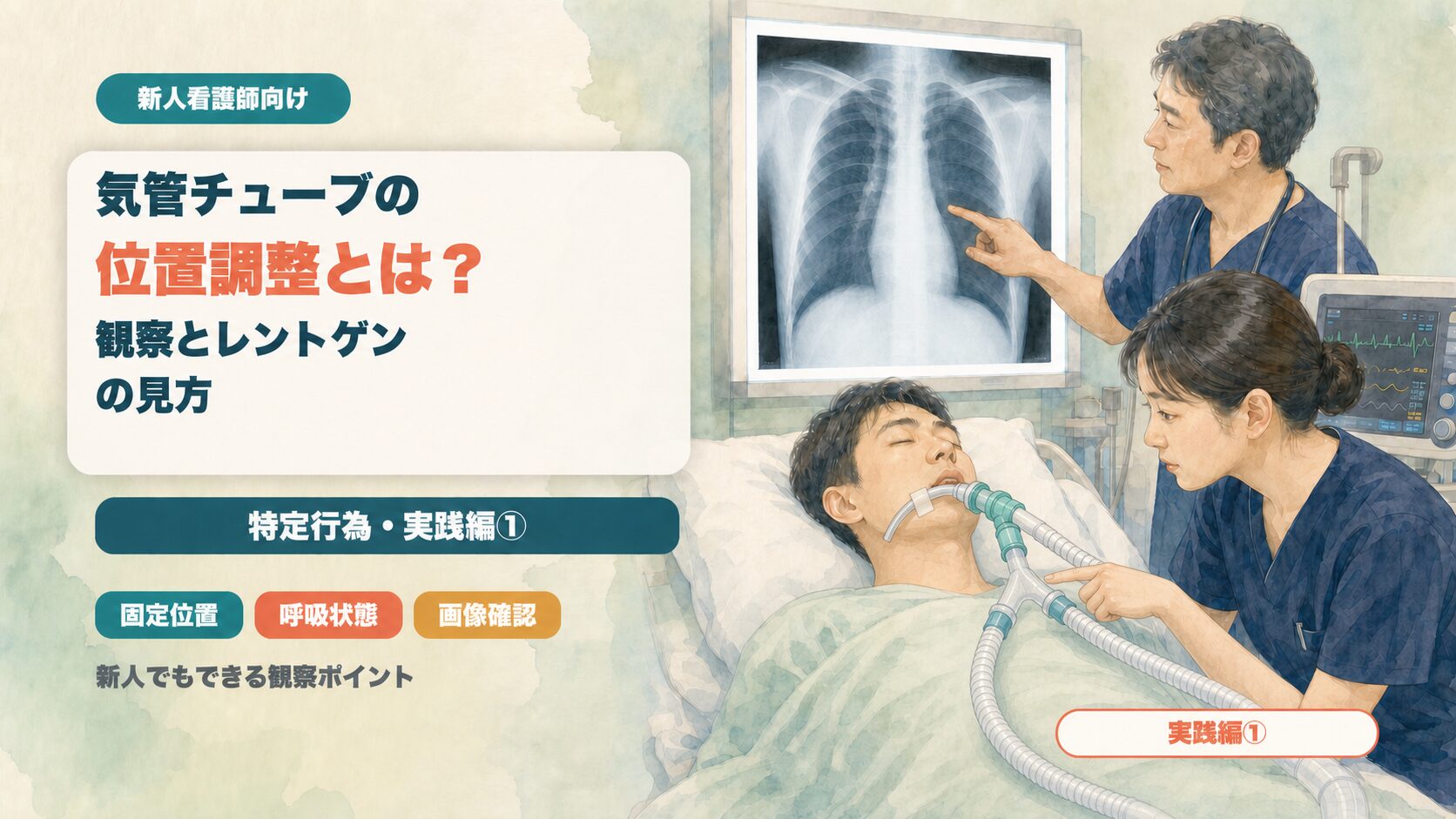 気管チューブの位置調整とは？｜新人でもできる観察とレントゲンの見方【特定行為・実践編①】